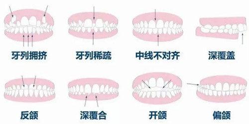 2025青岛最佳牙科医院排行揭晓，艾诺、牙博士等哪家医院好？附详细评价和收费信息(图2)