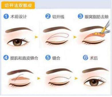 温州下巴整形医院排名：附温州下巴整形价格一览