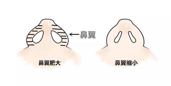上海七星艺容术整形医院地址？上海七星艺容术整形医院做隆鼻多少钱？