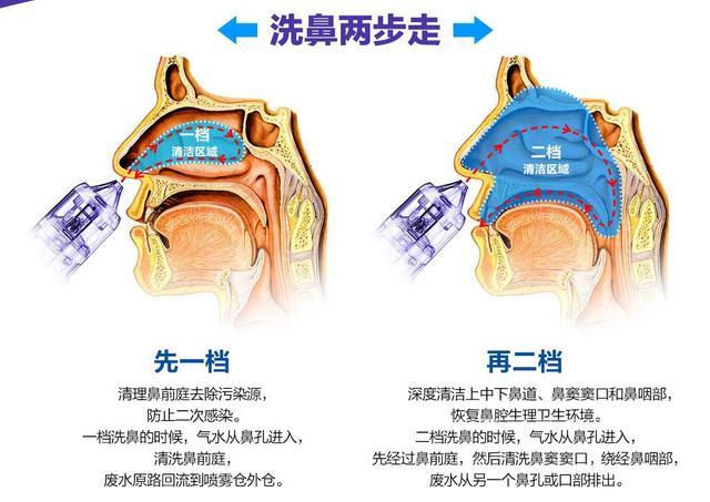 广西南宁熠美整形有做隆鼻好的医生吗？医生详细介绍！