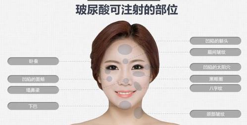 广美整形美容医院正规吗？附上案例信息和医生推荐！(图1)