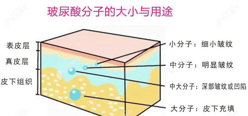 了解少女针和玻尿酸区别后你选择哪种呢？看看有哪些区别呢？
