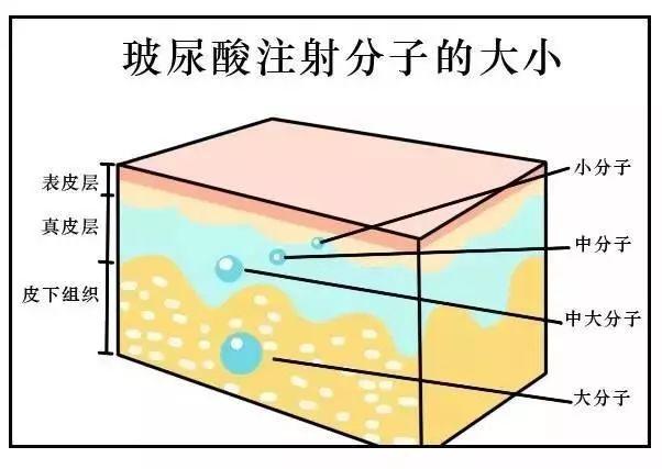 磨颧骨前后对比图明显吗？磨颧骨整形手术选择杭州连天美、北京八大处如何？