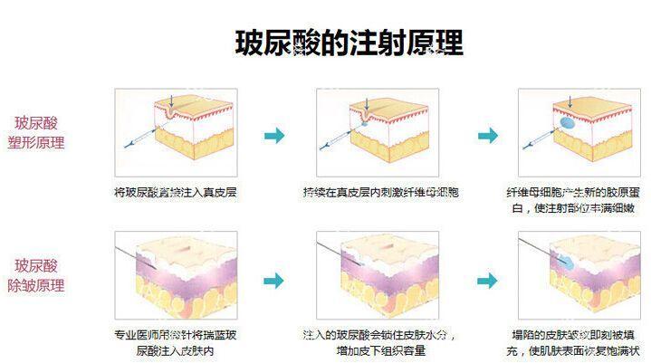 成都成美整形医院哪个医生技术好？技术特点各不同，任你选！