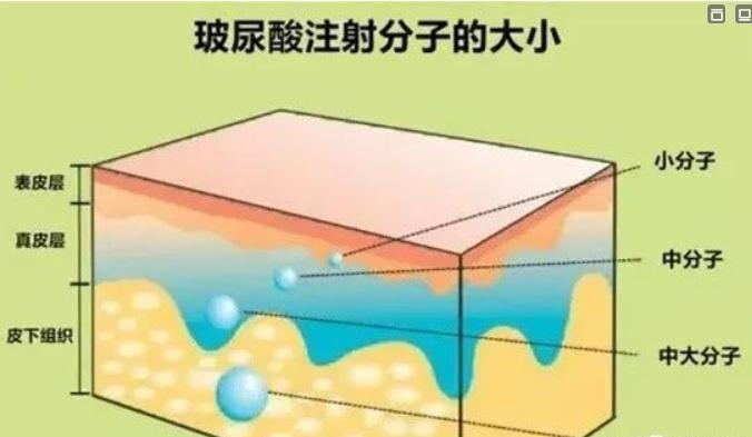 成都晶肤医美是上市公司吗？戳这里知道医生信息及擅长项目优势！