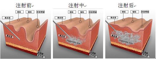 成都正规医美排名前十是哪些？华西、成都八大处详情分享(图1)