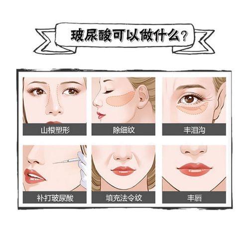 艾莉薇玻尿酸不能吸收吗？艾莉薇玻尿酸不能吸收是错误的