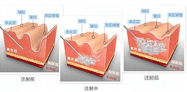 龙岩长汀县皮肤病防治院整形价格表公示，错过就没有啦！(图1)