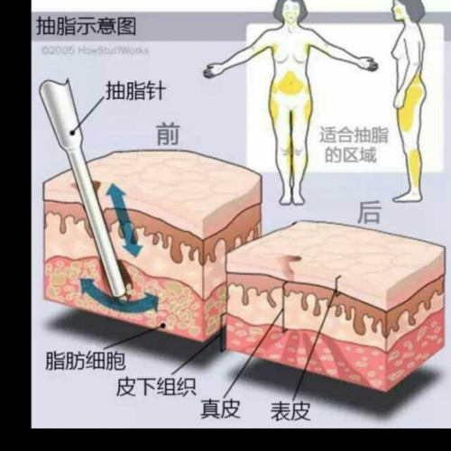 铜雀台美容医院正规吗？医院打水光针的技术如何？(图1)
