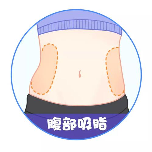 上海艾汀格医疗美容科普-肌肉小手臂可以做抽脂手术吗？