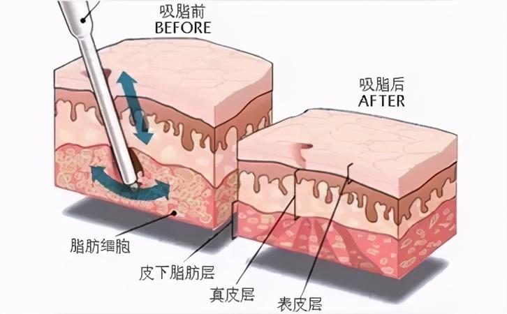 东莞第六人民医院美容科怎么样？盘点医院基本信息和实力医生！