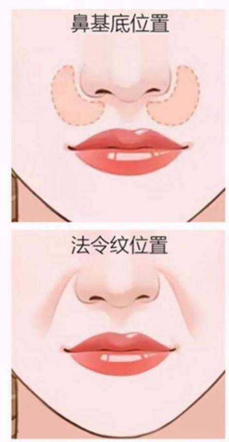 北京加减美曹正东做v3面部提升效果如何？效果很自然值得选