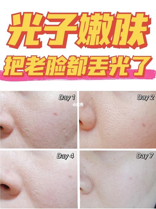 铜陵晶美整形美白嫩肤怎么样？肌肤胜雪的秘密原来在这里