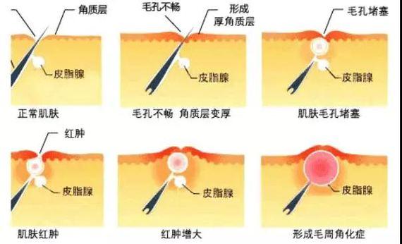 武汉美都美白嫩肤价格？既要漂亮又要省钱，看好别选贵了！