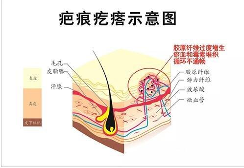 郑州第二中医院疤痕科怎么样？做激光祛疤行不行，案例有吗？