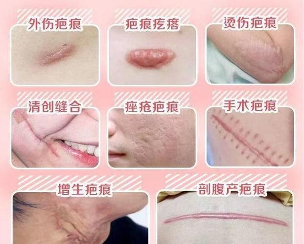 丽婵整形美容医院怎么样？武汉丽婵整形美容医院医生技术，整形案例！
