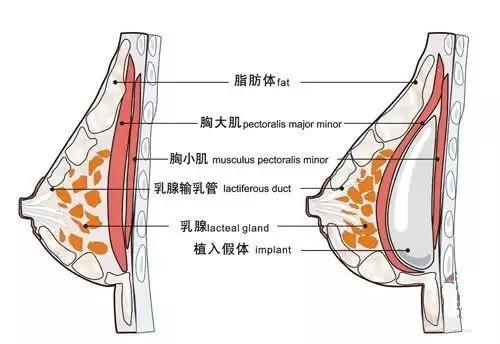 天津坤如玛丽整形医院怎么样？天津坤如玛丽整形医院能做隆胸吗？