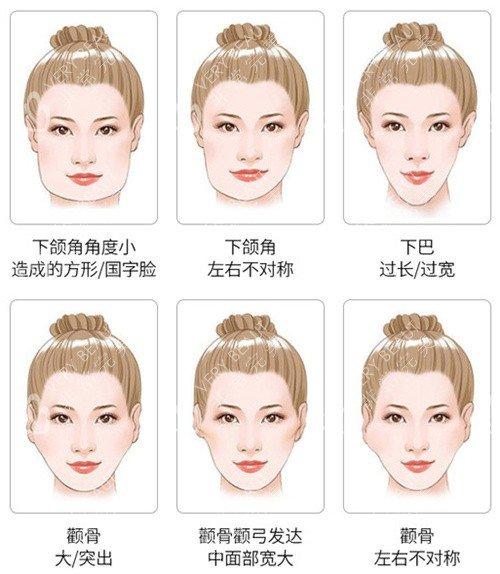 北京圣嘉新张笑天磨骨技术怎么样？找他做三件套8.3w真的可信吗？
