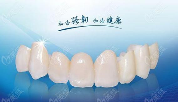 国内广泛使用的拉瓦全瓷牙一颗价格是多少？性价比高不高呢？