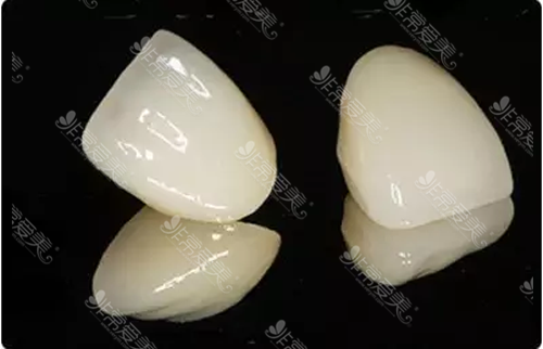 国产全瓷牙冠品牌评价一览：哪种品牌好，价格如何，效果咋样？(图1)