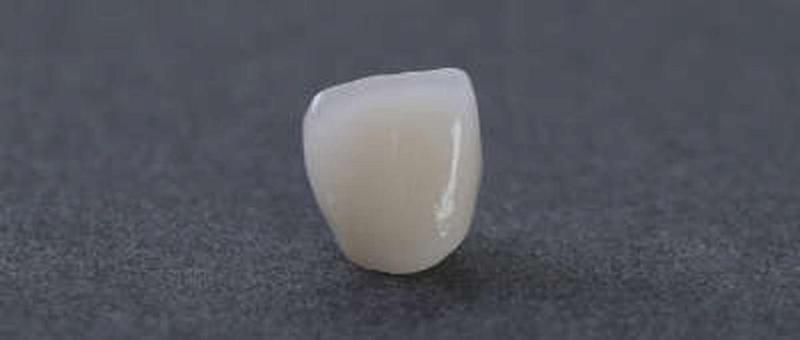 陶瓷牙和烤瓷牙哪个好？想了解这些知识这篇文章不容错过！