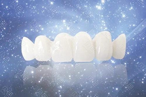 全瓷牙和铸瓷牙哪个好？铸瓷牙的保养要知道