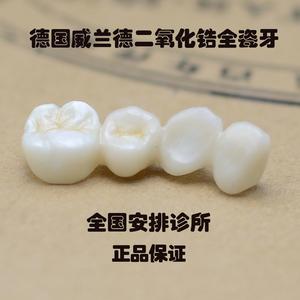 全瓷牙和瓷贴面哪个好？瓷贴面牙的适应症范围介绍给大家