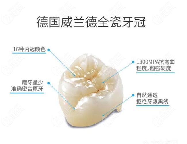 做完烤瓷牙后很多人后悔，原因揭秘：这项技术到底怎么样？医生口碑如何？(图1)
