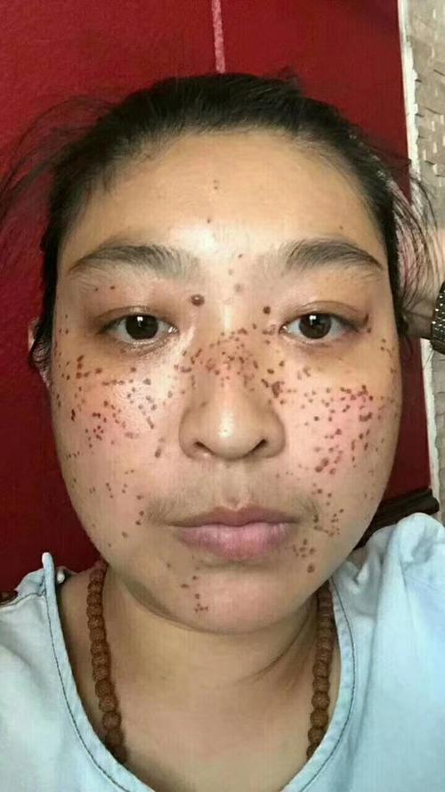 大连天一医疗美容怎么样？医院环境地址，热门项目，客户口碑分享！