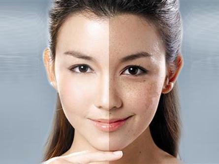成都做皮秒技术好的医院？八大处、艺星、美莱等上榜！