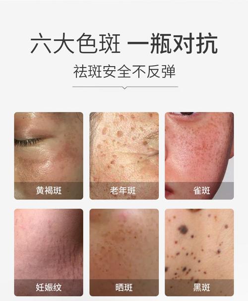 天津伊曼整形美容医院怎么样？天津伊曼整形美容医院祛斑费用？(图1)