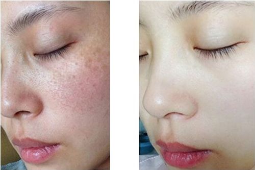 东莞依谋美容医院专业，热门项目收费合理，推荐医生技