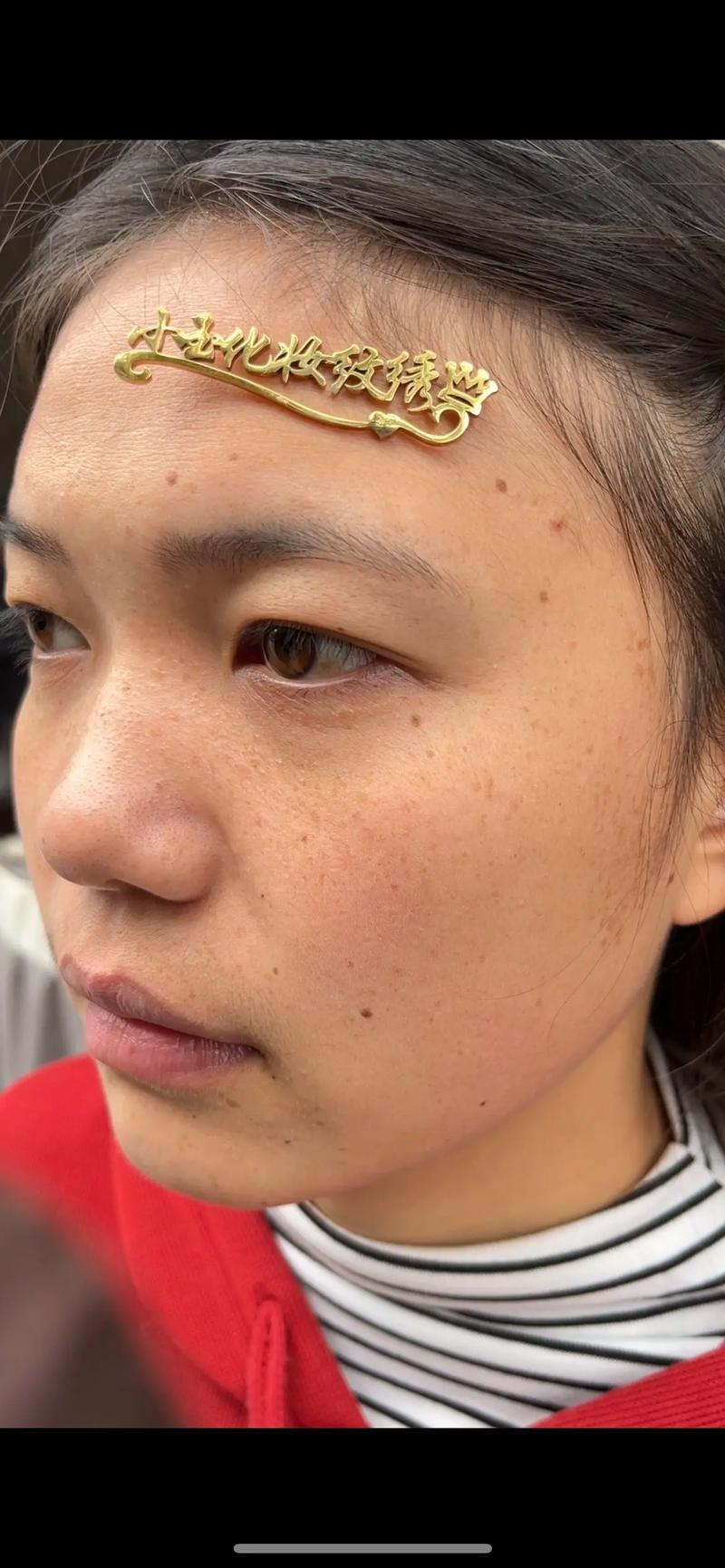 水玲珑医美怎么样？长沙水玲珑医美做祛斑好吗？多少钱？