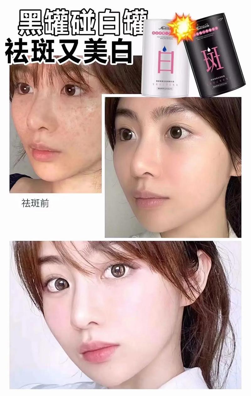 青岛市市立皮肤美容科能做激光祛斑吗？费用高吗？