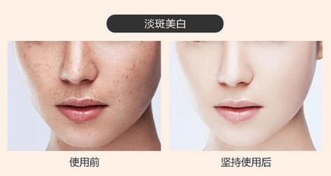成都晶肤医疗美容如何？整友反馈这是家实力雄厚且技术好的医院！