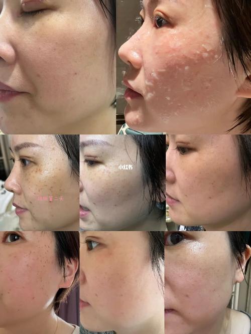 合肥恒美整形是正规医院吗？地址、医生，案例分享！