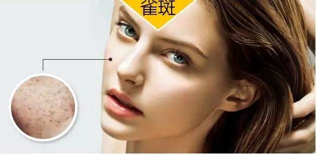 天津格美天颜怎么样？天津格美天颜美容医院能做祛斑吗？