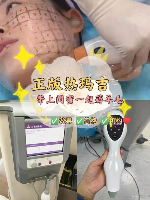 上海做热玛吉较好的医院，时光整形能不能做呢？