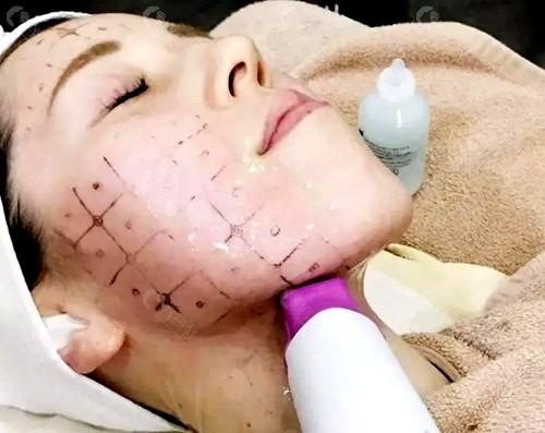 福州仁禾整形医院怎么样？做去皱手术靠谱吗？附案例分析+价格！