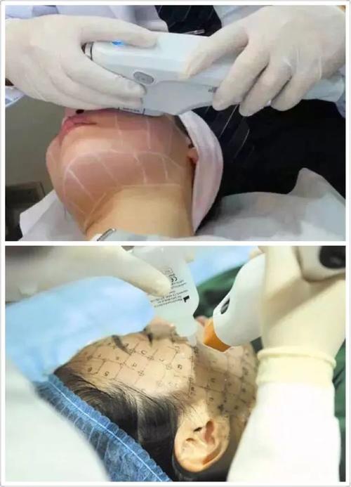 广州南方医院有做热玛吉吗？哪些医院有通过热玛吉认证呢？