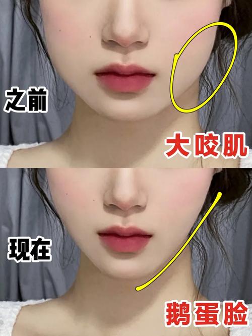 湘雅附二瘦脸针哪个医生好？瘦脸针注射费用多少，案例分享！(图1)