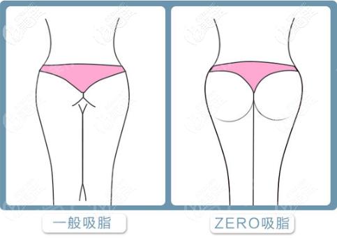 福州海峡整形医院怎么样，医生团队实力强大