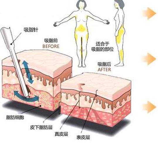 武汉中翰整形外科医院好吗？来看医生技术，热门项目，客户口碑！