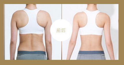 东莞艾莱美整形医院正规吗？医院医生技术+整形案例分享！