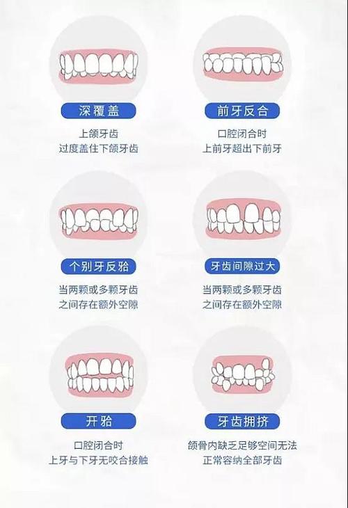 揭秘隐形矫正牙齿的费用：价格表一览，了解不同城市、医院、医生收费差异(图1)