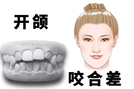 地包天什么时候能看出来-造成地包天的原因