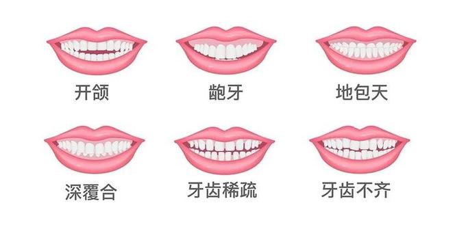 牙齿贴面和矫正冲突吗，牙贴面手术案例分析