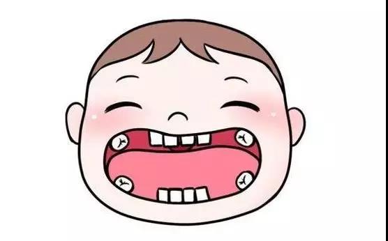 牙片拍哪个角度的？怎么通过全景片看有没有智齿？(图1)