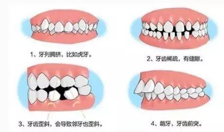 西安西京口腔医院洗牙多少钱？医院口碑好不好？洗牙之后需要注意哪些？