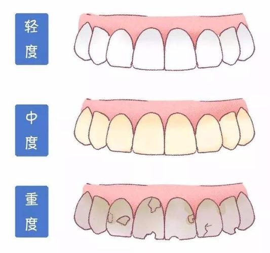 南京牙齿正畸哪个医院？牙齿不齐不要怕，南京口碑医院帮你解除烦恼！